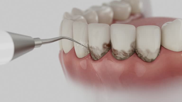 Reliable Dental contractor in Lakeport, TX by Dentist Open Now